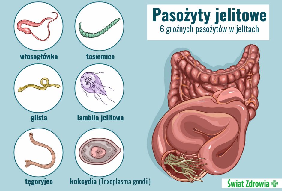 Jakie są objawy pasożytów?