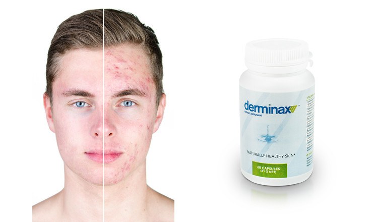Derminax - co to jest i jak działa?
